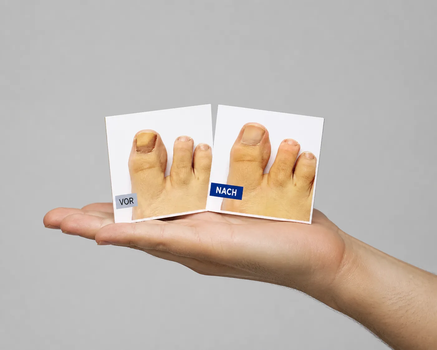 EXODERMIN EU — Verpackung in der Hand